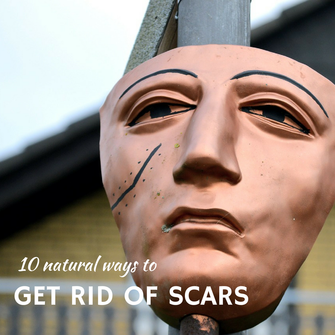 10 natural ways to get rid of scars