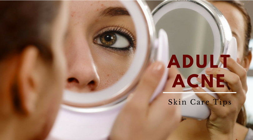 adult acne skin care tips