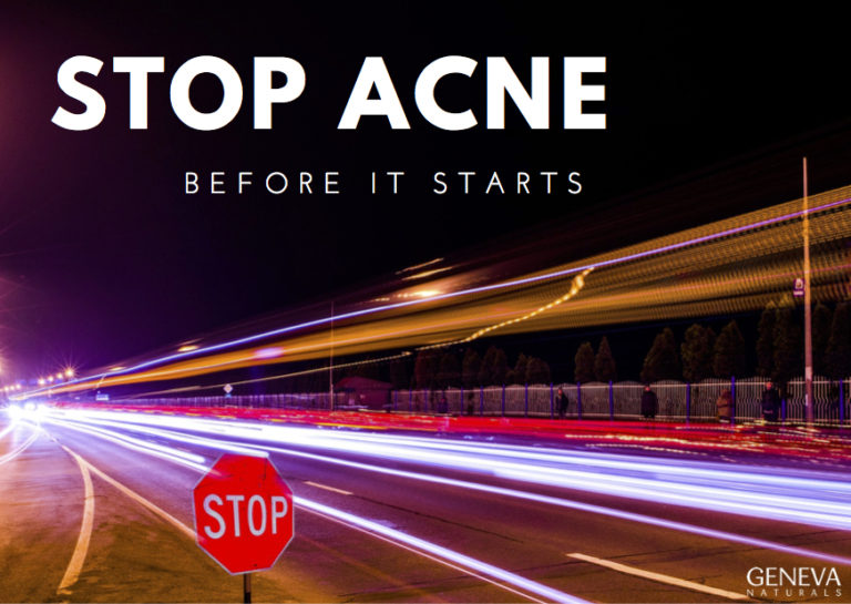 How to Stop Acne Before it Starts